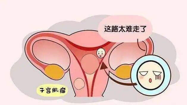 法院判决流产补偿_多次流产彩礼纠纷_因彩礼分手打胎女贬值
